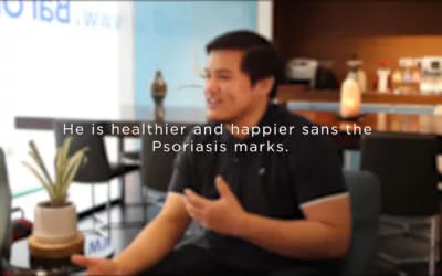 Treat Psoriasis Through the Healing Power of Food
